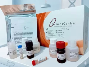 Bộ xét nghiệm định tính kháng thể IgG kháng Clonorchis