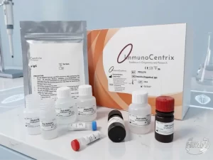 Bộ xét nghiệm định tính kháng thể IgG kháng Fasciola hepatica