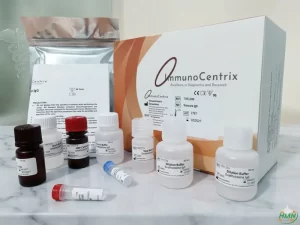 Bộ xét nghiệm định tính kháng thể IgG kháng Toxocara